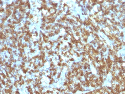 Monoclonal Antibody to CD45RO (T-Cell Marker)(Clone : SPM125)