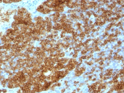 Monoclonal Antibody to CD45RA (Leucocyte Marker)(Clone : SPM568)