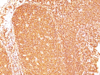 Monoclonal Antibody to CD45RB (B-Cell Marker)(Clone : PD7/26)