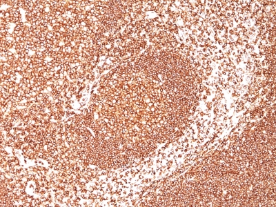 Monoclonal Antibody to CD45 / LCA (Leucocyte Marker)(2B11 + PD7/26)