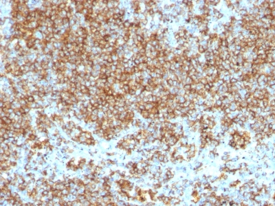 Monoclonal Antibody to CD45 / LCA (Leucocyte Marker)(SPM569 + SPM570)