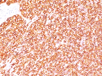 Monoclonal Antibody to CD45RB (B-Cell Marker)(Clone : BRA-11; same as BRA-11G)