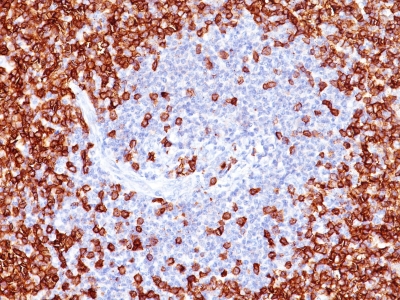 Monoclonal Antibody to CD45RO (T-Cell Marker)(Clone : T200/797)