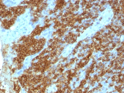 Monoclonal Antibody to CD45RA (Leucocyte Marker)(Clone : 111-1C5)