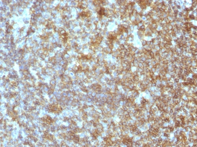 Monoclonal Antibody to CD45RA (Leucocyte Marker)(Clone : SPM504)