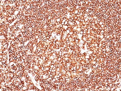 Monoclonal Antibody to CD45 / LCA (Leucocyte Marker)(Clone : 135-4C5)