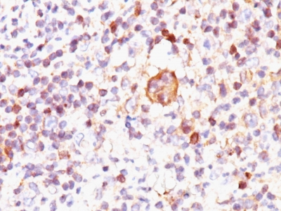 Monoclonal Antibody to Bax (Apoptosis Marker)(Clone : 2D2)