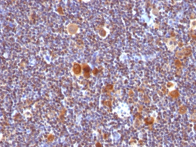 Monoclonal Antibody to Bax (Apoptosis Marker)(Clone : SPM336)