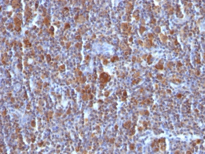 Monoclonal Antibody to Bax (Apoptosis Marker)(Clone : BAX/962)