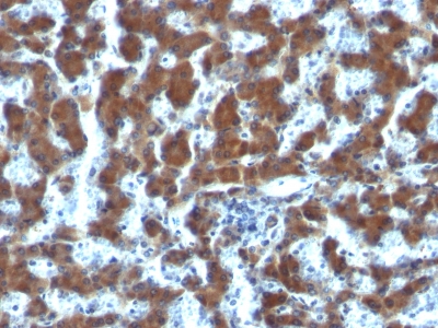 Monoclonal Antibody to Retinol Binding Protein-1 (RBP1)(Clone : G4E4)