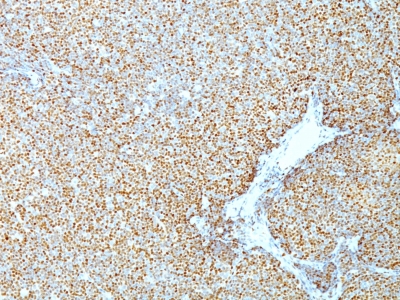 Monoclonal Antibody to Cyclin D1 (G1-Cyclin & Mantle Cell Marker)(Clone : CCND1/809)