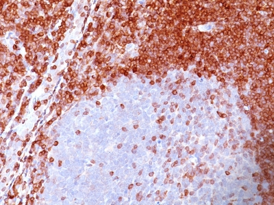 Monoclonal Antibody to Bcl-2 (Apoptosis & Follicular Lymphoma Marker)(Clone : 100/D5)