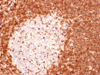 Monoclonal Antibody to Bcl-2 (Apoptosis & Follicular Lymphoma Marker)(Clone : 8C8)