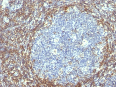 Monoclonal Antibody to Bcl-2 (Apoptosis & Follicular Lymphoma Marker)(Clone : BCL2/782)