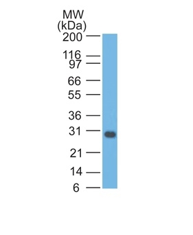 Monoclonal Antibody to Bcl-X (Apoptosis Marker)(Clone : BX006)