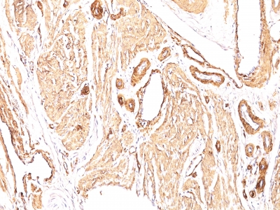 Monoclonal Antibody to Actin, Smooth Muscle (Leiomyosarcoma Marker)(Clone : 1A4; same as asm-1)