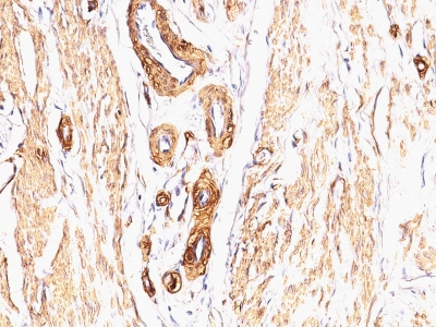 Monoclonal Antibody to Actin, Smooth Muscle (Leiomyosarcoma Marker)(Clone : SPM332)