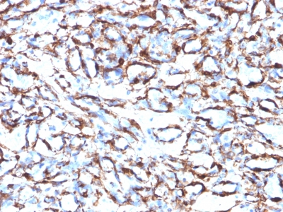 Monoclonal Antibody to Actin, Smooth Muscle (Leiomyosarcoma Marker)(Clone : ACTA2/791)