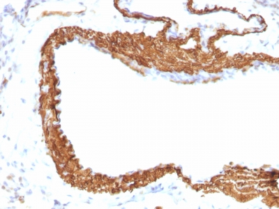 Monoclonal Antibody to Actin, Smooth Muscle (Leiomyosarcoma Marker)(1A4 + ACTA2/791)