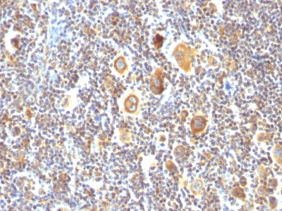 Monoclonal Antibody to Bcl-6 (Follicular Lymphoma Marker)(Clone : BCL6/850)(Discontinued)