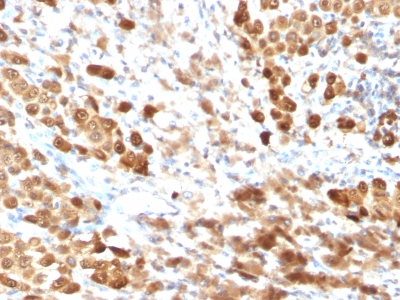 Monoclonal Antibody to S100A1 (Astrocyte Marker)(Clone : SPM354)(Discontinued)(Discontinued)