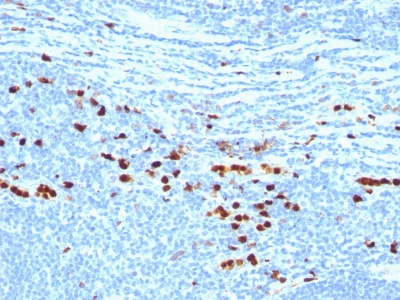 Monoclonal Antibody to Macrophage L1 Protein(Clone : MAC387)