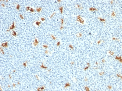 Monoclonal Antibody to S100A9 (Macrophage Marker)(Clone : S100A9/1011)