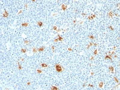 Monoclonal Antibody to Calgranulin B (Macrophage Marker)(Clone : CAGB/426)