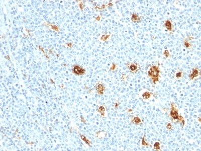 Monoclonal Antibody to Myeloid-Related Proteins 14 (MRP14) (Macrophage Marker)(Clone : MRP14/840)(Discontinued)