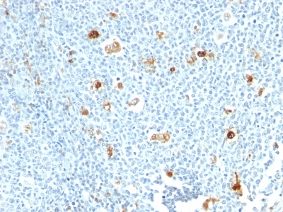 Monoclonal Antibody to Calprotectin (Macrophage Marker)(Clone : CPT/1028)