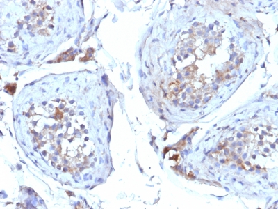 Monoclonal Antibody to Sex Hormone Binding Globulin (SHBG)(Clone : SHBG/245)