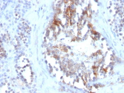 Monoclonal Antibody to Sex Hormone Binding Globulin (SHBG)(Clone : SPM605)