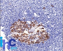 Monoclonal Antibody to CDw75 (B-Cell Marker)(Clone : LN-1)