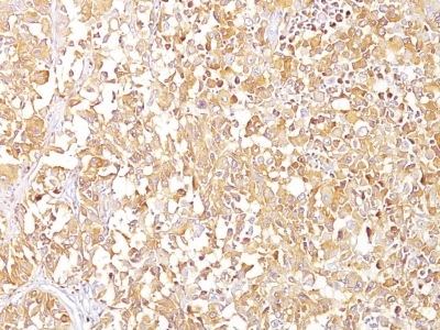 Monoclonal Antibody to gp100 / Melanosome / PMEL17 / SILV (Melanoma Marker)(Clone : SPM142)