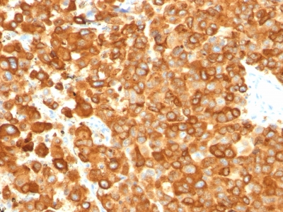 Monoclonal Antibody to gp100 / Melanosome / PMEL17 / SILV (Melanoma Marker)(Clone : PMEL/783)