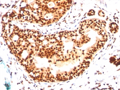 Monoclonal Antibody to SUMO-2/3(Clone : SM23/496)