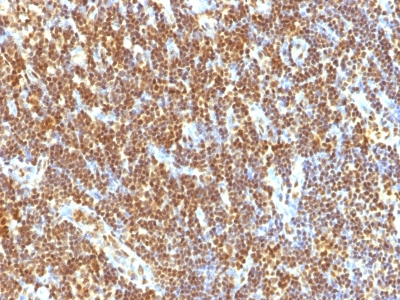 Monoclonal Antibody to SUMO-2(Clone : SUMO2/1199)