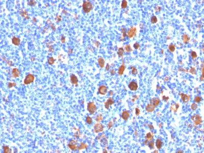 Monoclonal Antibody to Fascin-1 (Reed-Sternberg Cell Marker)(Clone : FSCN1/416)