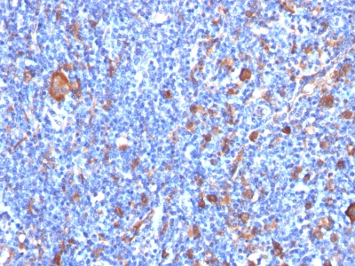 Monoclonal Antibody to Fascin-1 (Reed-Sternberg Cell Marker)(Clone : FSCN1/417)