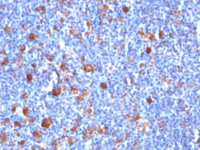 Monoclonal Antibody to Fascin-1 (Reed-Sternberg Cell Marker)(Clone : SPM133)