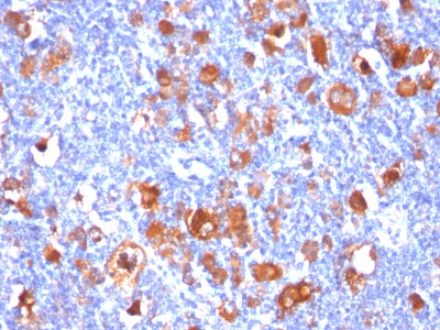 Monoclonal Antibody to Fascin-1 (Reed-Sternberg Cell Marker)(Clone : FSCN1/418)