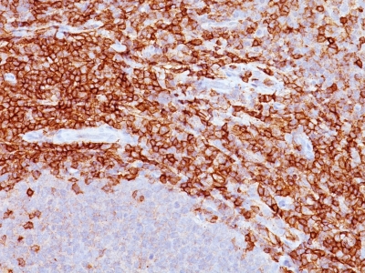 Monoclonal Antibody to CD43 (T-Cell Marker)(Clone : SPM503)