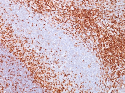 Monoclonal Antibody to CD43 (T-Cell Marker)(Clone : SPN/839)