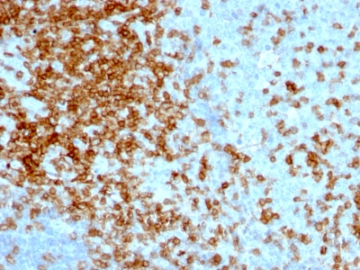 Monoclonal Antibody to CD43 (T-Cell Marker)(Clone : 84-3C1)