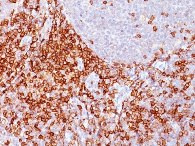 Monoclonal Antibody to CD43 (T-Cell Marker)(Clone : Bra7G)