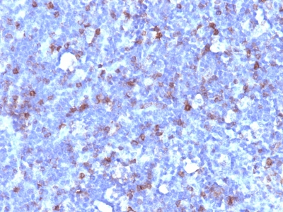 Monoclonal Antibody to CD43 (T-Cell Marker)(Clone : SPN/1094)