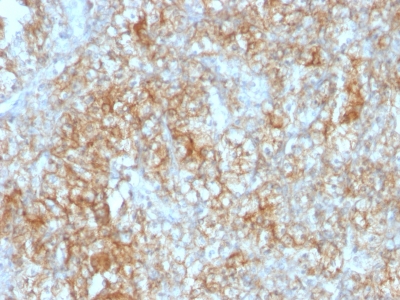 Monoclonal Antibody to CD147 / EMMPRIN / Neurothelin(Clone : 8D6)