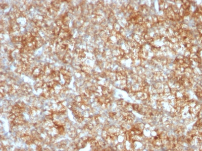 Monoclonal Antibody to CD147 / EMMPRIN / Neurothelin(Clone : BSG/963)