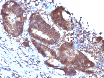 Monoclonal Antibody to Transgelin (SM22-alpha)(Clone : TAGLN/247)