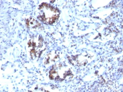 Monoclonal Antibody to Transgelin (SM22-alpha)(Clone : SPM606)